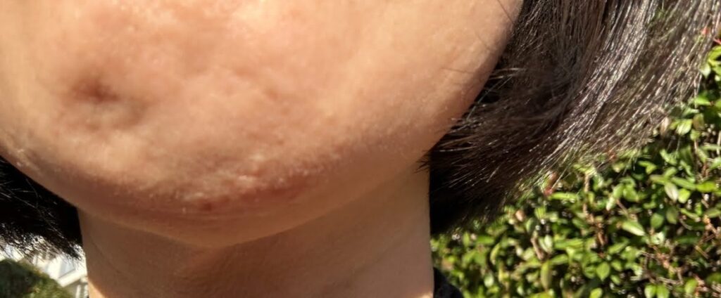 現在のアゴの写真